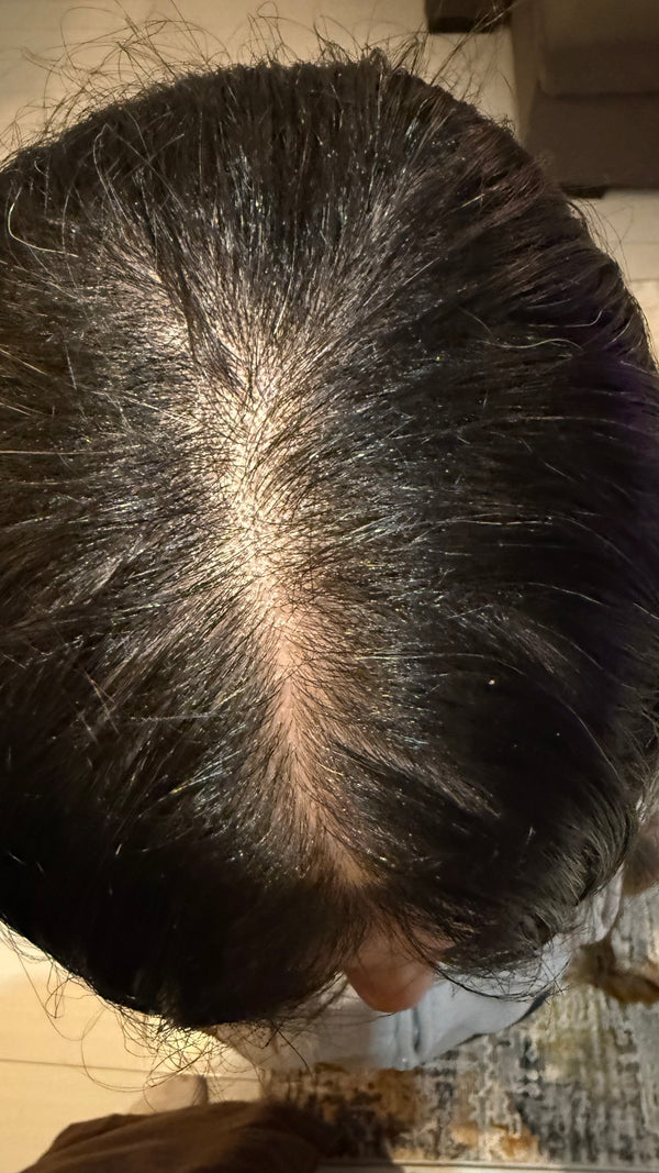 Before - Customer result