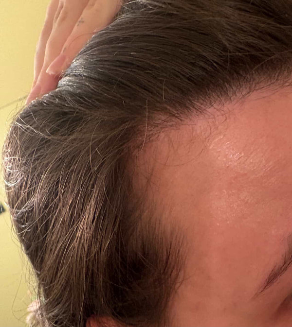 After - Customer result