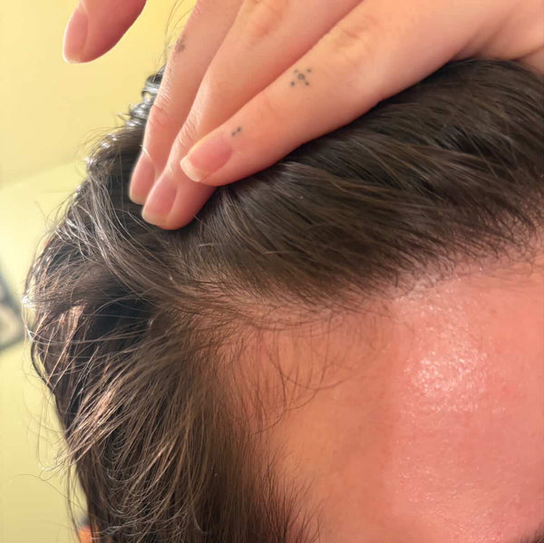 Before - Customer result