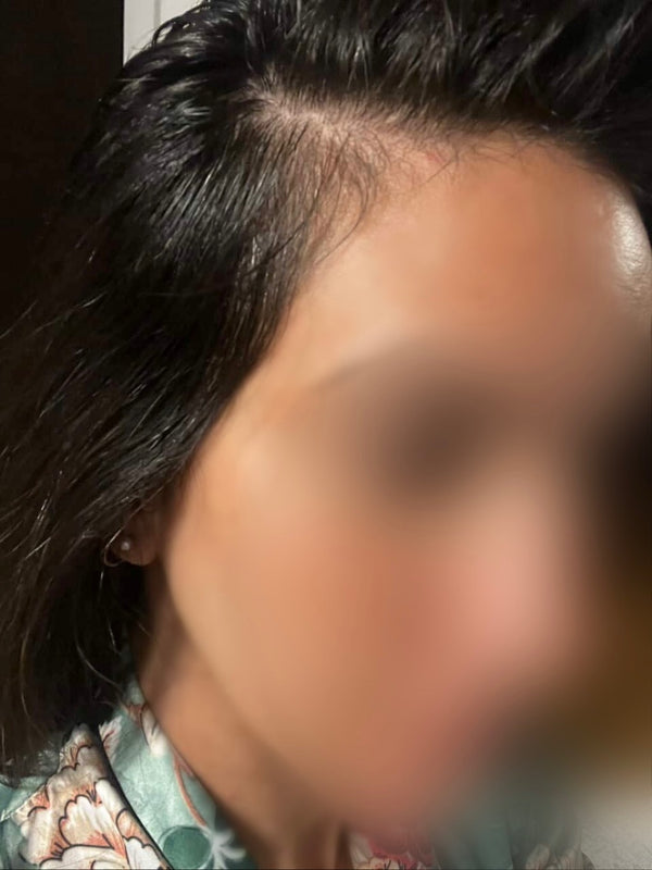 Before - Customer result